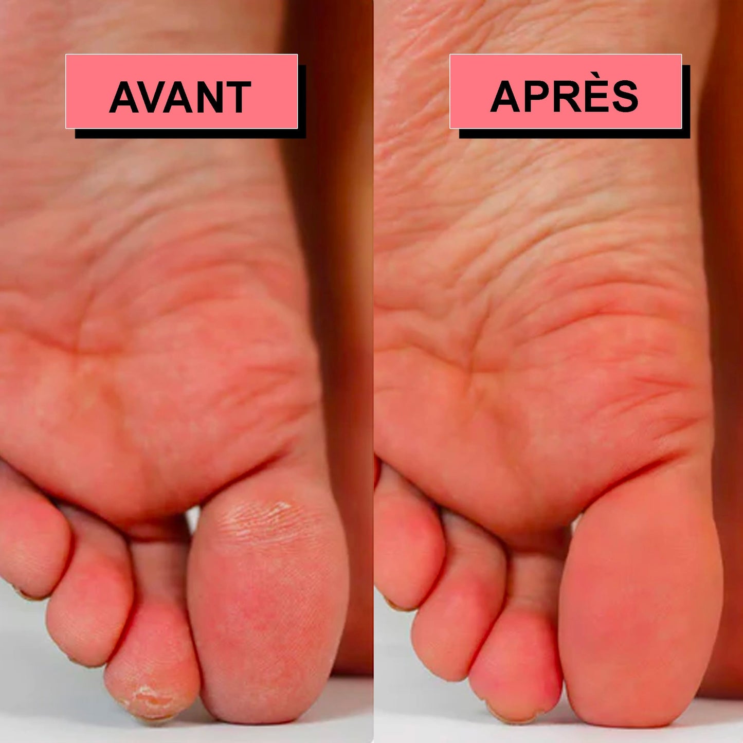 Rape à pied électrique - Launchify