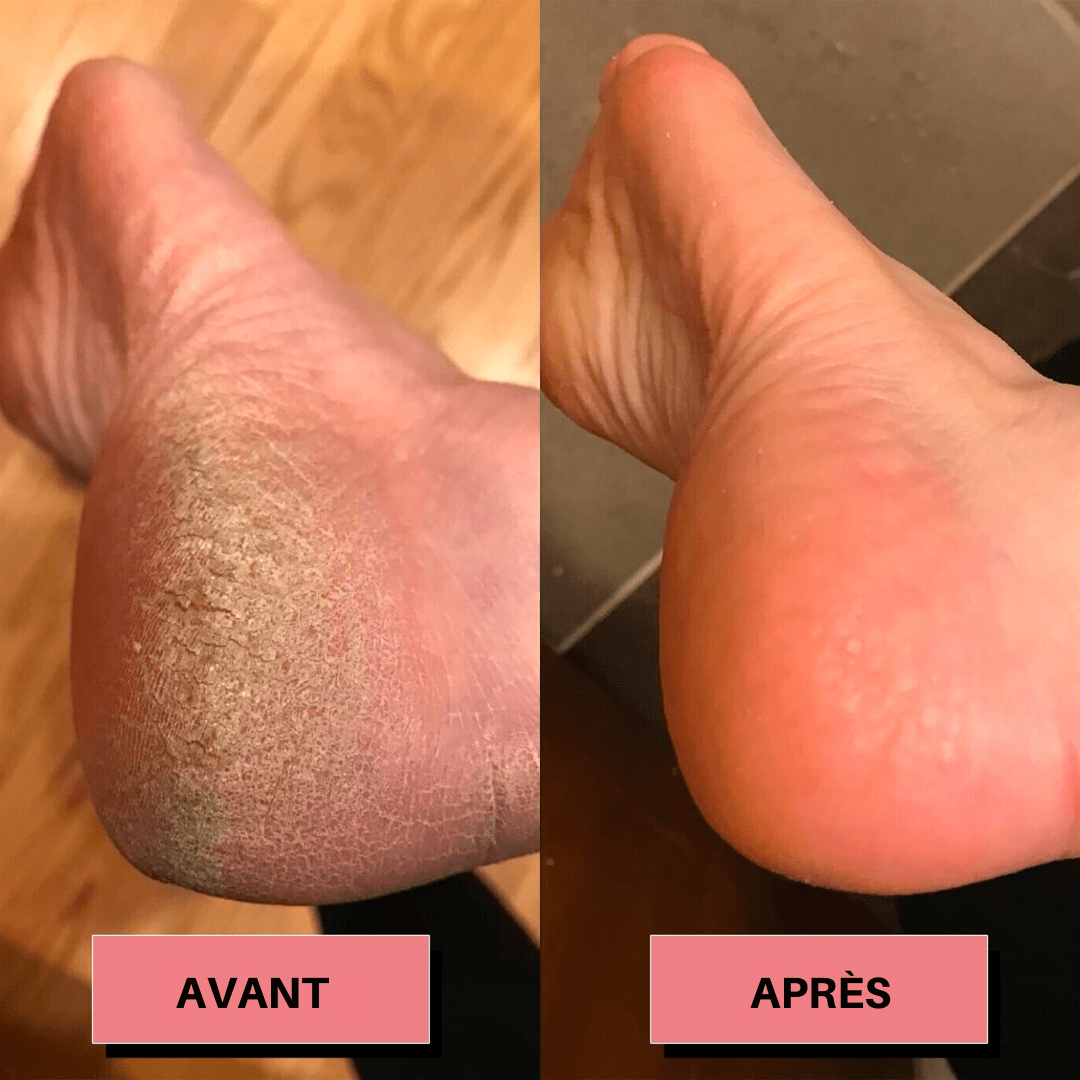 Rape à pied électrique - Launchify