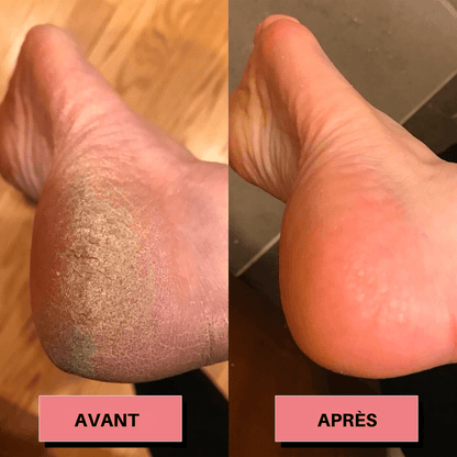 Rape à pied électrique - Launchify